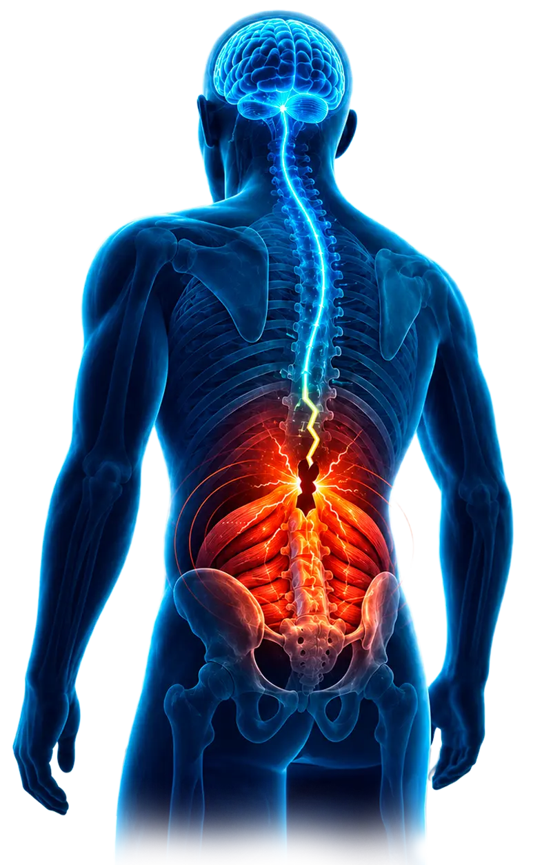 Ilustração médica da coluna e curto-circuito neural na lombar